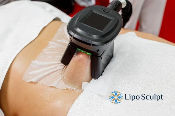 Does Fat Freezing at Home Work? DIY Devices vs Professional Cryolipolysis 1 How is professional cryolipolysis different East Tilbury?
