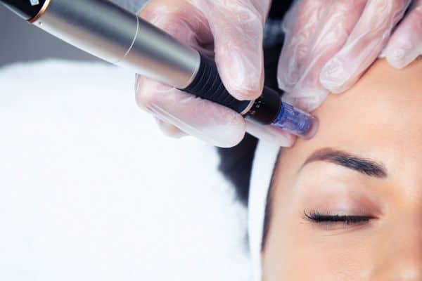 Explaining Total Skin Tightening Treatment and What to Expect 2 What Skin Concerns Can Total Skin Tightening Treatment Help With East Tilbury?